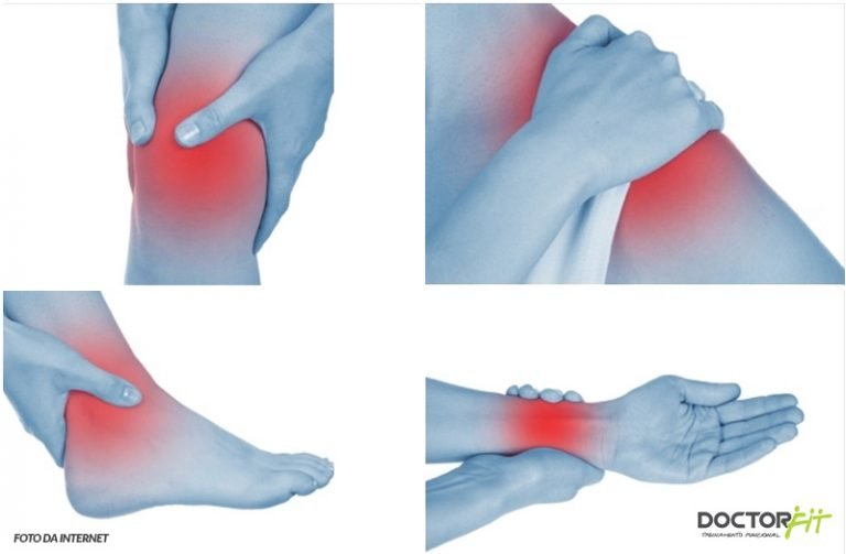 TENDINITE ou TENOSSINOVITE? - DoctorFit | Franquia de treinamento ...